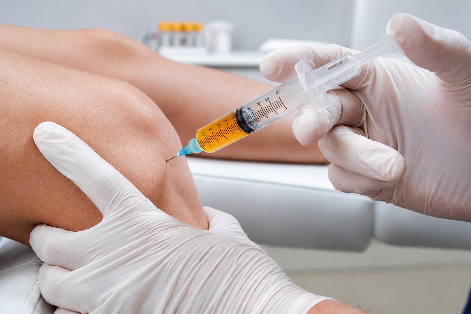 Orthobiologics treatment at Dr. Vinoth's Advanced Ortho Clinic